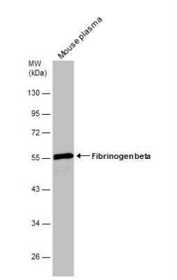 Western Blot: Fibrinogen beta chain Antibody [NBP1-33582]