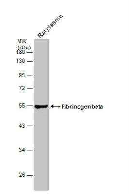 Western Blot: Fibrinogen beta chain Antibody [NBP1-33582]