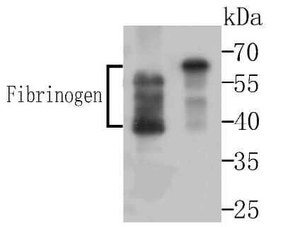 Western Blot: Fibrinogen Antibody [NBP2-80414]