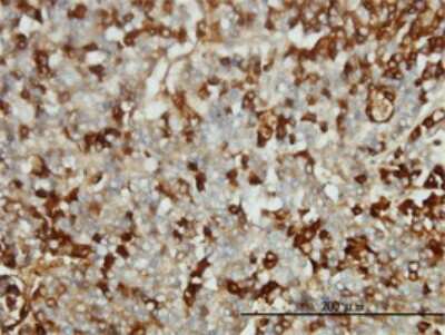 Immunohistochemistry-Paraffin: Fibrinogen gamma chain Antibody (1F2) [H00002266-M01]