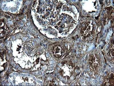 Immunohistochemistry: Fibrinogen gamma chain Antibody (OTI2D2) [NBP2-45663]