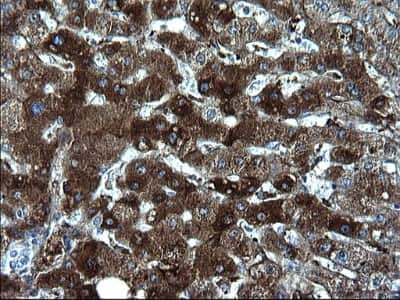 Immunohistochemistry: Fibrinogen gamma chain Antibody (OTI2D2) [NBP2-45663]