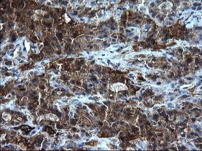 Immunohistochemistry: Fibrinogen gamma chain Antibody (OTI2D2) [NBP2-45663]