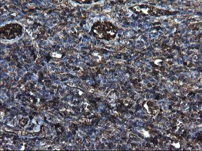 Immunohistochemistry: Fibrinogen gamma chain Antibody (OTI2D2) [NBP2-45663]