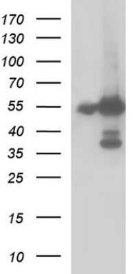 Western Blot: Fibrinogen gamma chain Antibody (OTI2D2) [NBP2-45663]