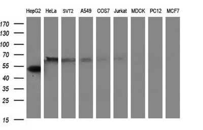 Western Blot: Fibrinogen gamma chain Antibody (OTI2D2) [NBP2-45663]