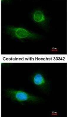 Immunocytochemistry/ Immunofluorescence: Fibrinogen gamma chain Antibody [NBP1-31766]