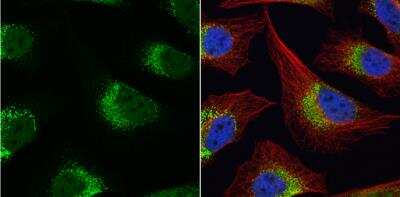 Immunocytochemistry/ Immunofluorescence: Fibrinogen gamma chain Antibody [NBP1-32436]