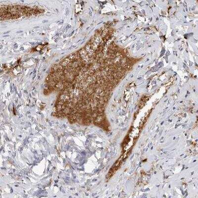 Immunohistochemistry: Fibrinogen gamma chain Antibody [NBP1-87448]