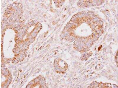 Immunohistochemistry-Paraffin: Fibrinogen gamma chain Antibody [NBP1-31766]