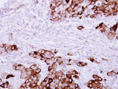 Immunohistochemistry-Paraffin: Fibrinogen gamma chain Antibody [NBP1-32436]