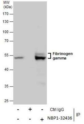 Immunoprecipitation: Fibrinogen gamma chain Antibody [NBP1-32436]