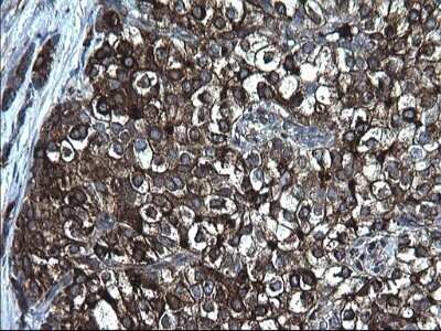 Immunohistochemistry: Fibrinogen gamma chain Antibody (OTI2D2) - Azide and BSA Free [NBP2-70732]