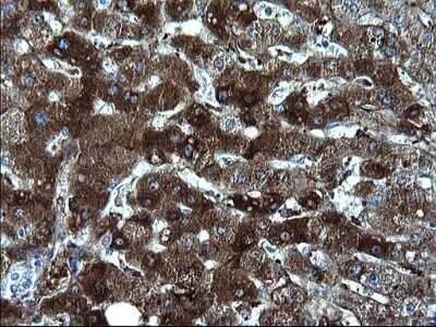 Immunohistochemistry: Fibrinogen gamma chain Antibody (OTI2D2) - Azide and BSA Free [NBP2-70732]