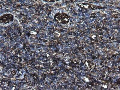 Immunohistochemistry: Fibrinogen gamma chain Antibody (OTI2D2) - Azide and BSA Free [NBP2-70732]