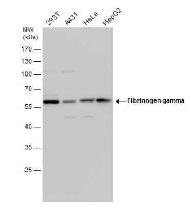 Western Blot: Fibrinogen gamma chain Antibody [NBP1-31766]