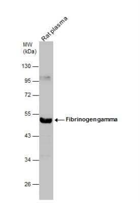 Western Blot: Fibrinogen gamma chain Antibody [NBP1-32436]