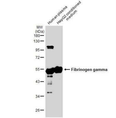 Western Blot: Fibrinogen gamma chain Antibody [NBP1-32436]