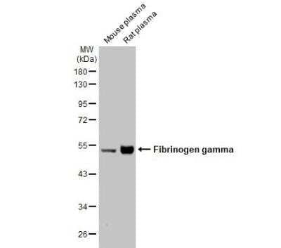 Western Blot: Fibrinogen gamma chain Antibody [NBP1-32436]