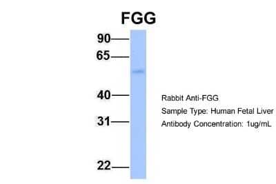 Western Blot: Fibrinogen gamma chain Antibody [NBP1-69291]