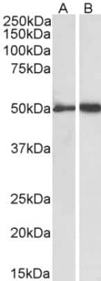 Western Blot: Fibrinogen gamma chain Antibody [NBP2-42497]