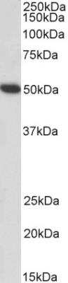 Western Blot: Fibrinogen gamma chain Antibody [NBP2-42498]