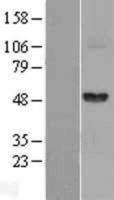 Western Blot: Fibrinogen gamma chain Overexpression Lysate [NBL1-10708]