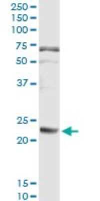 Immunoprecipitation: Fibrinopeptide A Antibody (1D12) [H00002243-M01]