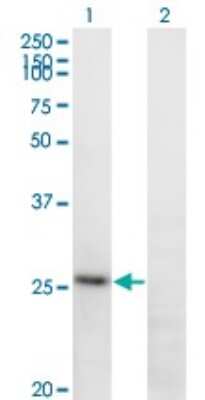 Western Blot: Fibrinopeptide A Antibody (1D12) [H00002243-M01]