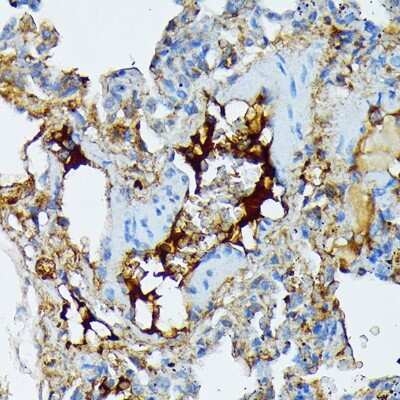 Immunohistochemistry-Paraffin: Fibrinopeptide A Antibody (7K8J1) [NBP3-15843]