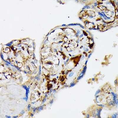 Immunohistochemistry-Paraffin: Fibrinopeptide A Antibody (7K8J1) [NBP3-15843]