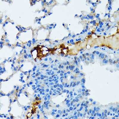 Immunohistochemistry-Paraffin: Fibrinopeptide A Antibody (7K8J1) [NBP3-15843]