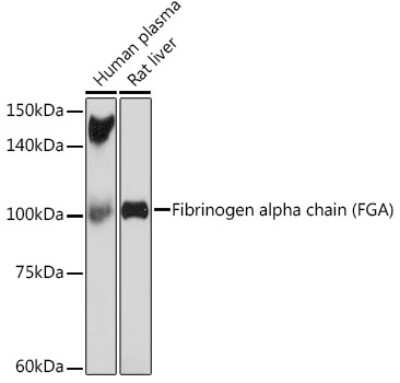 Western Blot: Fibrinopeptide A Antibody (7K8J1) [NBP3-15843]