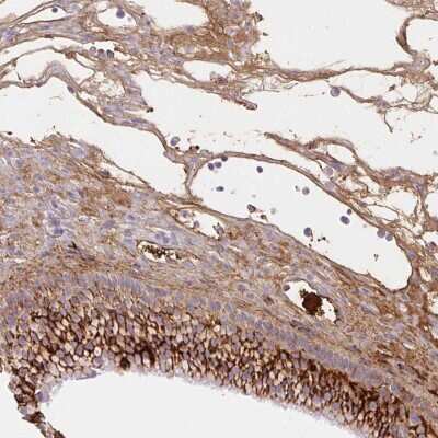 Immunohistochemistry: Fibrinopeptide A Antibody [NBP2-49424]