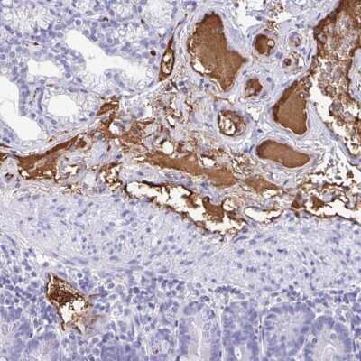 Immunohistochemistry-Paraffin: Fibrinopeptide A Antibody [NBP2-33613]