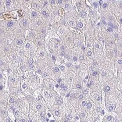 Immunohistochemistry-Paraffin: Fibrinopeptide A Antibody [NBP2-33613]