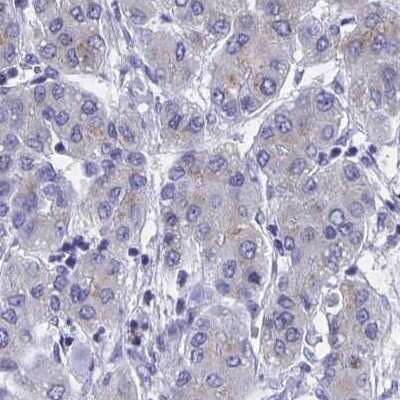 Immunohistochemistry-Paraffin: Fibrinopeptide A Antibody [NBP2-33613]