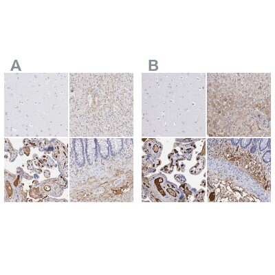 Immunohistochemistry-Paraffin: Fibrinogen beta chain Antibody [NBP1-90955]