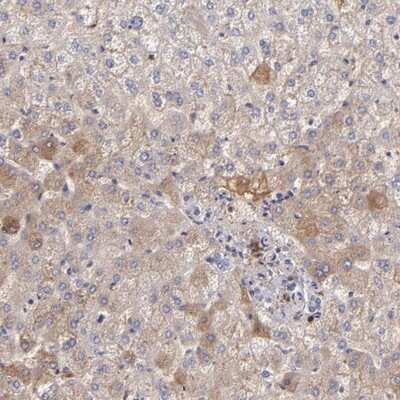 Immunohistochemistry-Paraffin: Fibrinogen beta chain Antibody [NBP1-90956]