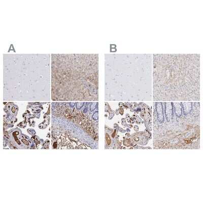 Immunohistochemistry-Paraffin: Fibrinogen beta chain Antibody [NBP1-90956]