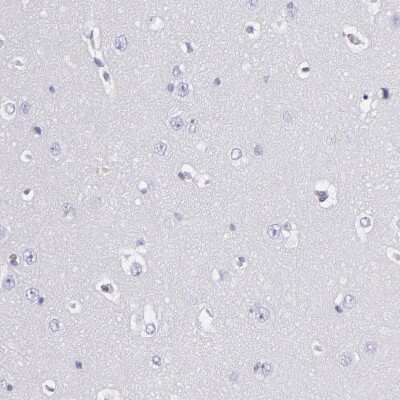 Immunohistochemistry-Paraffin: Fibrinogen beta chain Antibody [NBP1-90956]