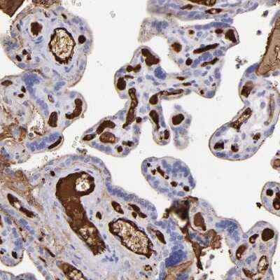 Immunohistochemistry-Paraffin: Fibrinogen beta chain Antibody [NBP1-90956]
