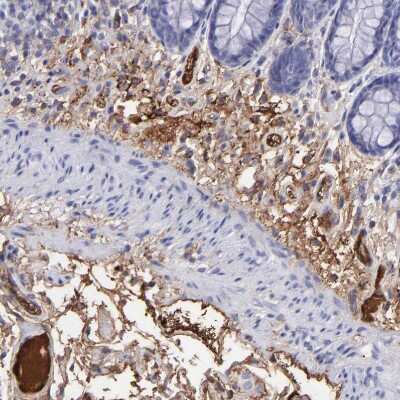Immunohistochemistry-Paraffin: Fibrinogen beta chain Antibody [NBP1-90956]