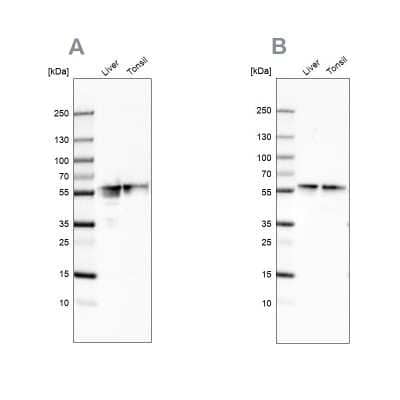 Western Blot: Fibrinogen beta chain Antibody [NBP1-90956]