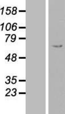 Western Blot: Fibrinogen beta chain Overexpression Lysate [NBL1-10684]