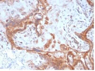 Immunohistochemistry-Paraffin: Fibroblast Activation Protein alpha/FAP Antibody (FAP/4851) [NBP3-13883]