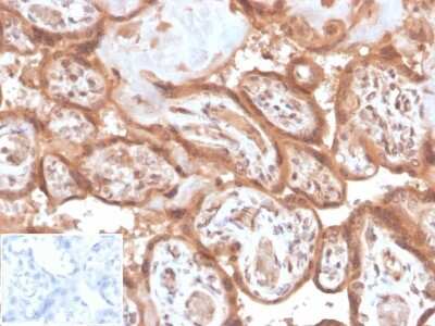 Immunohistochemistry-Paraffin: Fibroblast Activation Protein alpha/FAP Antibody (FAP/4853) [NBP3-13884]