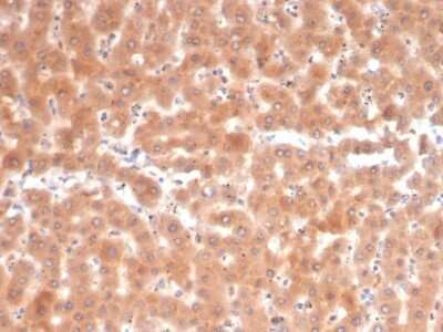 Immunohistochemistry-Paraffin: Fibroblast Activation Protein alpha/FAP Antibody (FAP/4853) [NBP3-13884]