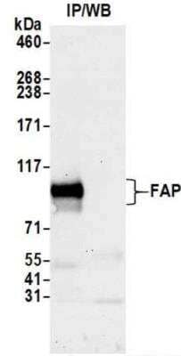 Immunoprecipitation: Fibroblast Activation Protein alpha/FAP Antibody (BLR150J) [NBP3-14728]