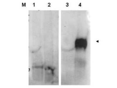 Western Blot: Fibroblast Activation Protein alpha/FAP Antibody [NB110-85534]